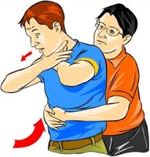 Tips to helping a choking person