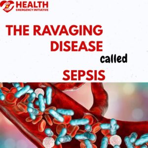 Sepsis