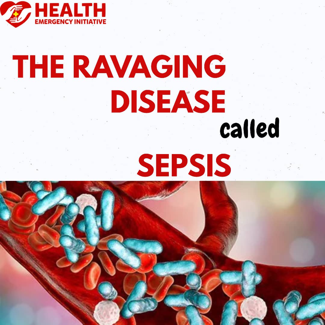 The Ravaging Disease Called ‘Sepsis’ II - Health Emergency Initiative